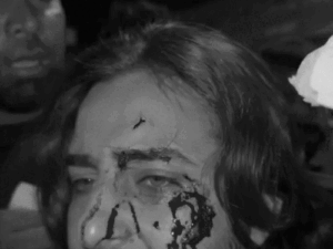Dhurandhar movie fame singer’s forehead bleeding: Khan saab hit a glass on his head during the shooting, when it pricked his forehead, it started bleeding – Jalandhar News