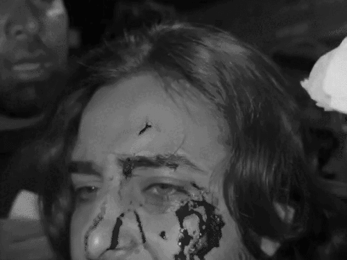 Dhurandhar movie fame singer’s forehead bleeding: Khan saab hit a glass on his head during the shooting, when it pricked his forehead, it started bleeding – Jalandhar News